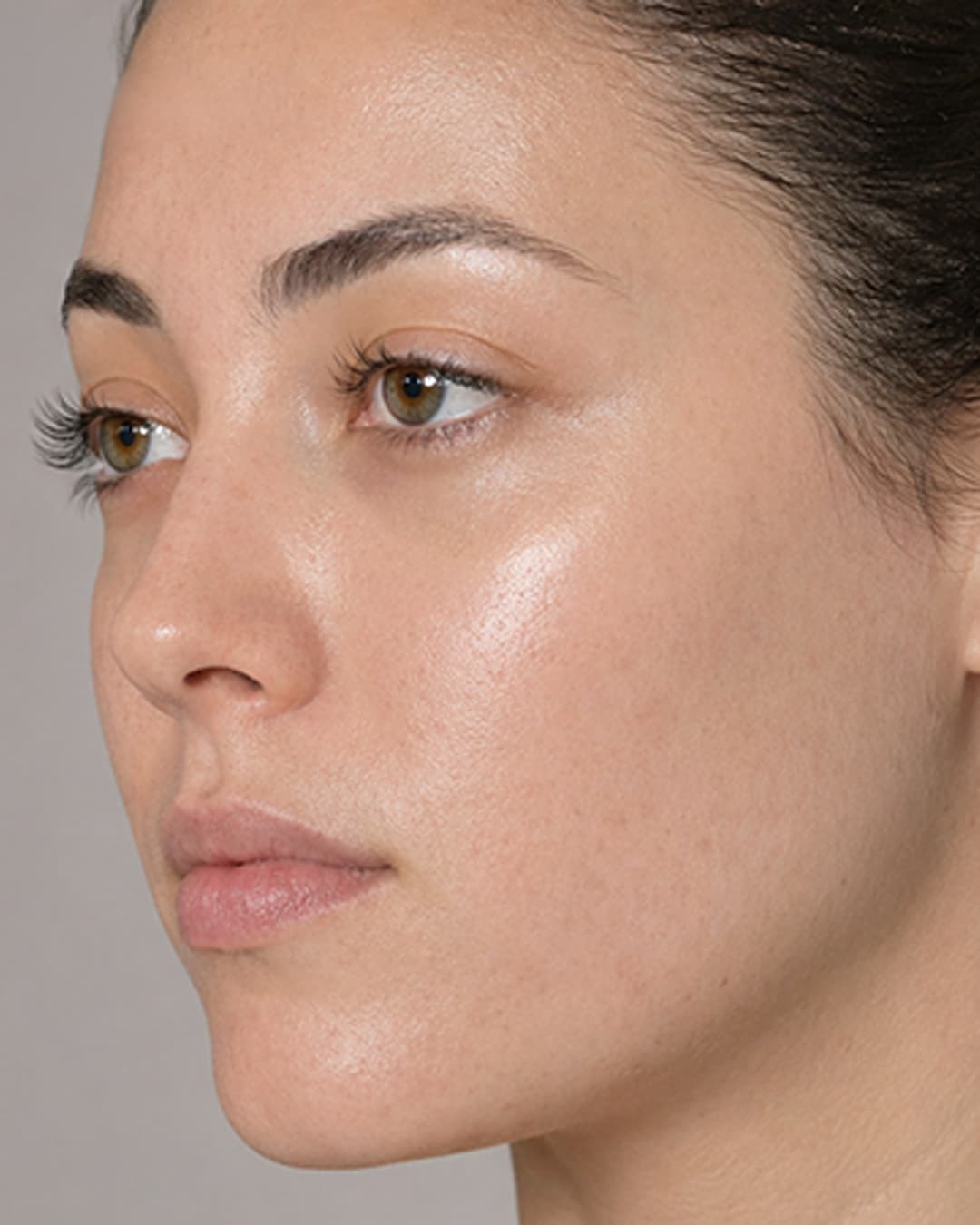 Skin progress at WK 10