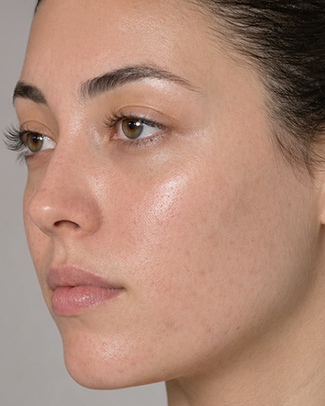 Skin progress at WK 06
